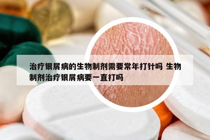 治療銀屑病的生物制劑需要常年打針嗎 生物制劑治療銀屑病要一直打嗎