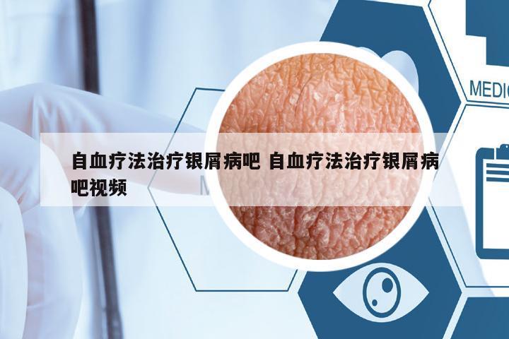 自血療法治療銀屑病吧 自血療法治療銀屑病吧視頻
