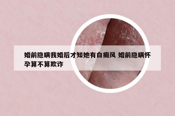 婚前隱瞞我婚后才知她有白癜風(fēng) 婚前隱瞞懷孕算不算欺詐