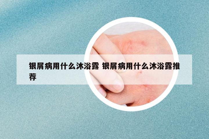 銀屑病用什么沐浴露 銀屑病用什么沐浴露推薦
