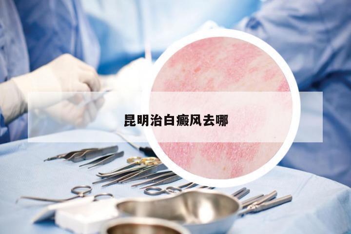 昆明治白癜風(fēng)去哪