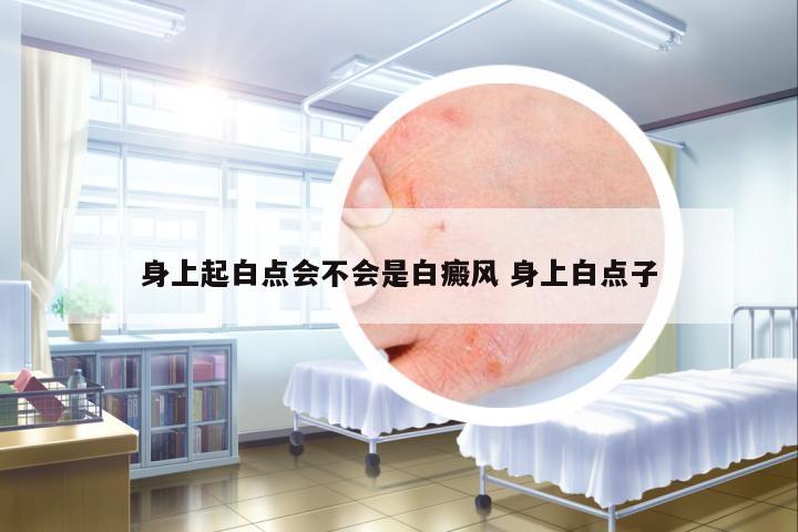 身上起白點(diǎn)會不會是白癜風(fēng) 身上白點(diǎn)子