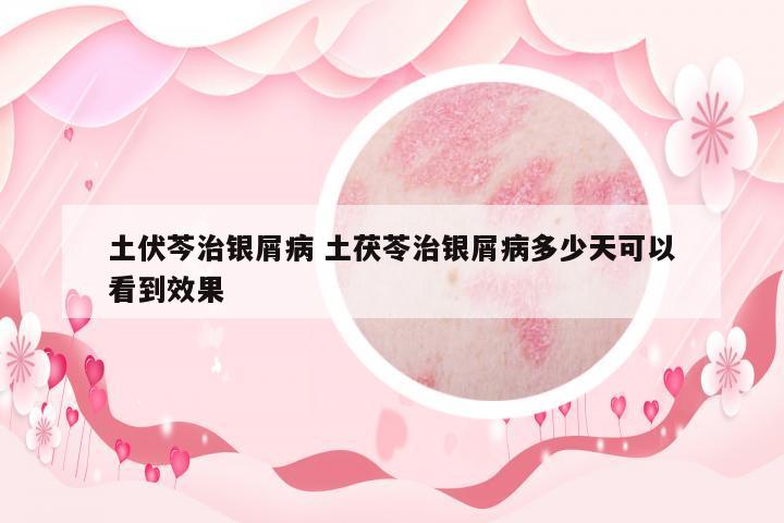 土伏芩治銀屑病 土茯苓治銀屑病多少天可以看到效果