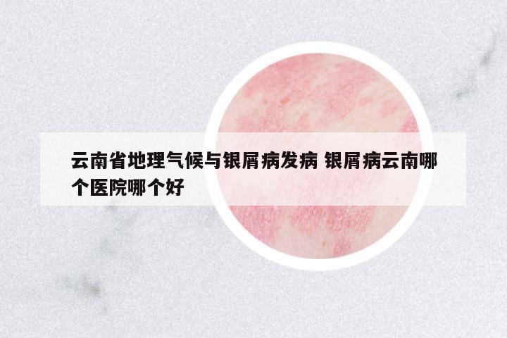 云南省地理氣候與銀屑病發(fā)病 銀屑病云南哪個(gè)醫(yī)院哪個(gè)好