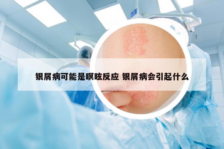 銀屑病可能是瞑眩反應(yīng) 銀屑病會引起什么