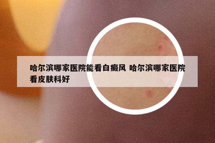 哈爾濱哪家醫(yī)院能看白癜風 哈爾濱哪家醫(yī)院看皮膚科好