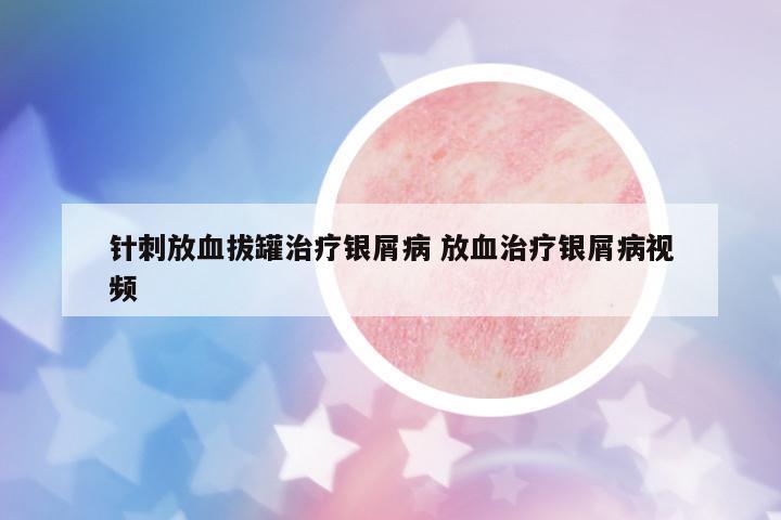 針刺放血拔罐治療銀屑病 放血治療銀屑病視頻