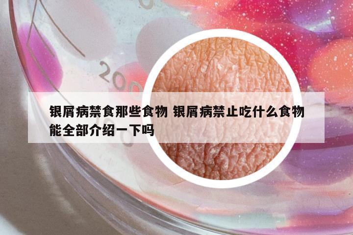 銀屑病禁食那些食物 銀屑病禁止吃什么食物能全部介紹一下嗎