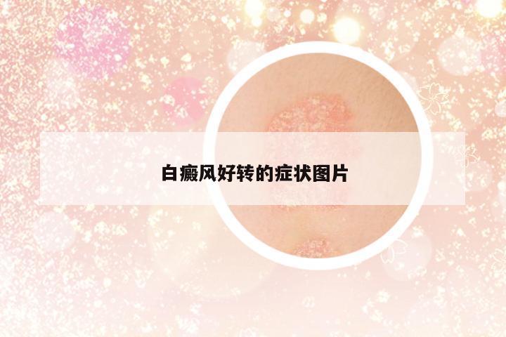 白癜風好轉(zhuǎn)的癥狀圖片