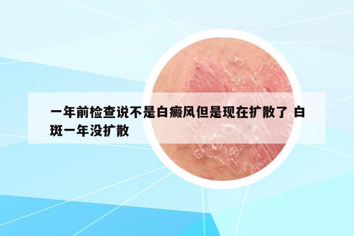 一年前檢查說(shuō)不是白癜風(fēng)但是現(xiàn)在擴(kuò)散了 白斑一年沒擴(kuò)散