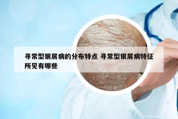 尋常型銀屑病的分布特點(diǎn) 尋常型銀屑病特征所見有哪些