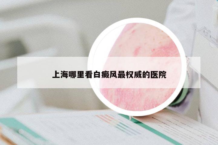 上海哪里看白癜風(fēng)最權(quán)威的醫(yī)院