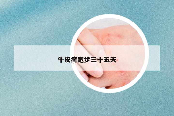 牛皮癬跑步三十五天