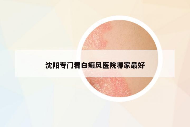 沈陽(yáng)專門看白癜風(fēng)醫(yī)院哪家最好