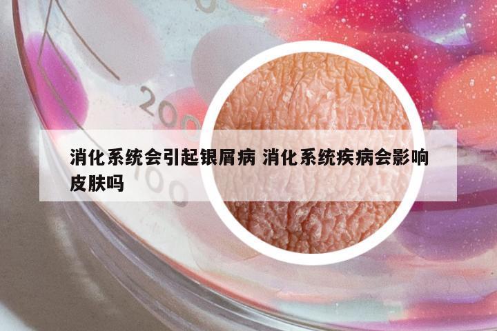 消化系統(tǒng)會引起銀屑病 消化系統(tǒng)疾病會影響皮膚嗎