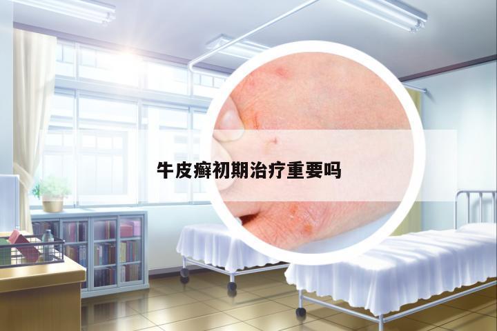 牛皮癬初期治療重要嗎