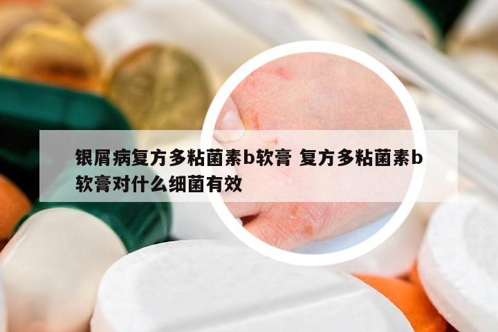 銀屑病復方多粘菌素b軟膏 復方多粘菌素b軟膏對什么細菌有效