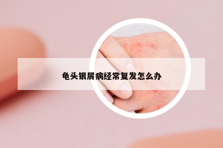 龜頭銀屑病經(jīng)常復(fù)發(fā)怎么辦