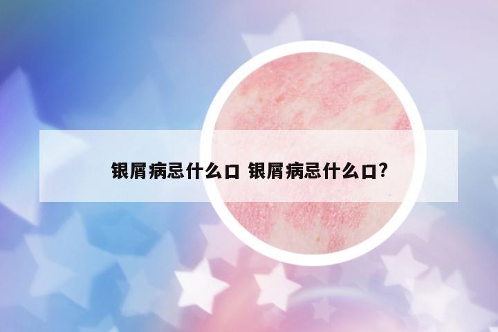 銀屑病忌什么口 銀屑病忌什么口?