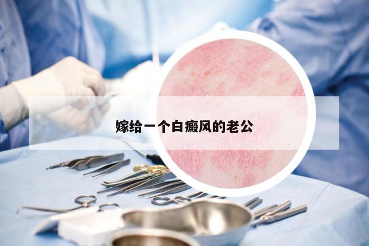 嫁給一個白癜風(fēng)的老公