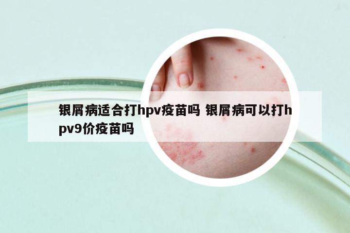銀屑病適合打hpv疫苗嗎 銀屑病可以打hpv9價(jià)疫苗嗎