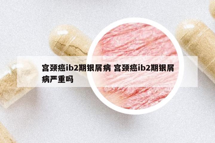 宮頸癌ib2期銀屑病 宮頸癌ib2期銀屑病嚴(yán)重嗎