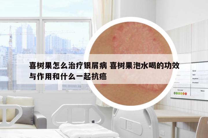 喜樹果怎么治療銀屑病 喜樹果泡水喝的功效與作用和什么一起抗癌