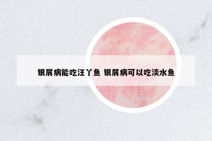 銀屑病能吃汪丫魚 銀屑病可以吃淡水魚