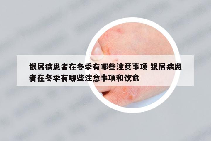 銀屑病患者在冬季有哪些注意事項 銀屑病患者在冬季有哪些注意事項和飲食