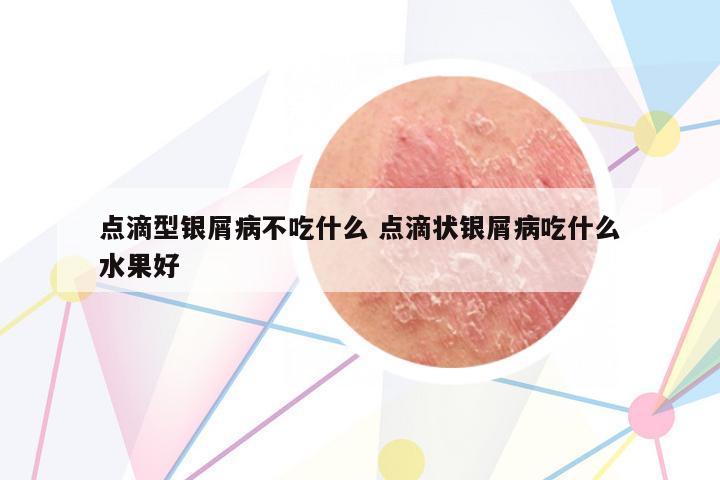 點滴型銀屑病不吃什么 點滴狀銀屑病吃什么水果好