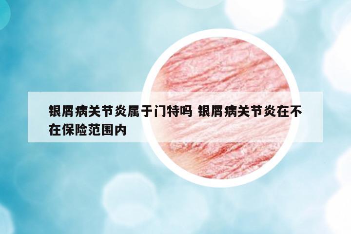 銀屑病關(guān)節(jié)炎屬于門特嗎 銀屑病關(guān)節(jié)炎在不在保險(xiǎn)范圍內(nèi)