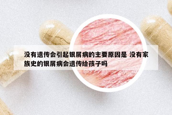 沒有遺傳會(huì)引起銀屑病的主要原因是 沒有家族史的銀屑病會(huì)遺傳給孩子嗎