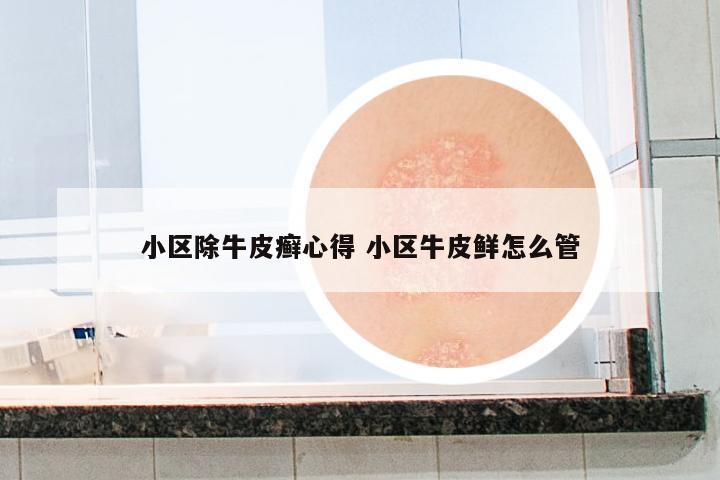 小區(qū)除牛皮癬心得 小區(qū)牛皮鮮怎么管