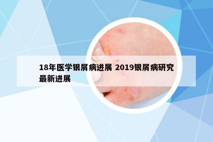 18年醫(yī)學(xué)銀屑病進(jìn)展 2019銀屑病研究最新進(jìn)展