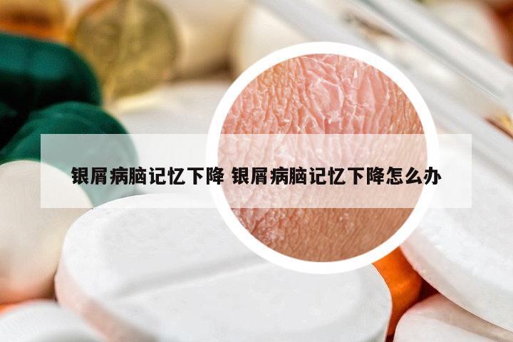 銀屑病腦記憶下降 銀屑病腦記憶下降怎么辦