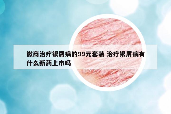 微商治療銀屑病的99元套裝 治療銀屑病有什么新藥上市嗎