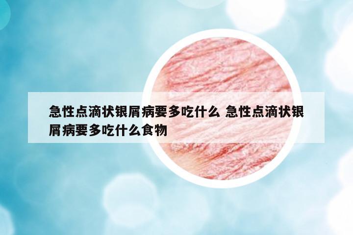 急性點滴狀銀屑病要多吃什么 急性點滴狀銀屑病要多吃什么食物