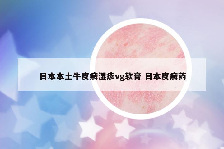 日本本土牛皮癬濕疹vg軟膏 日本皮癬藥