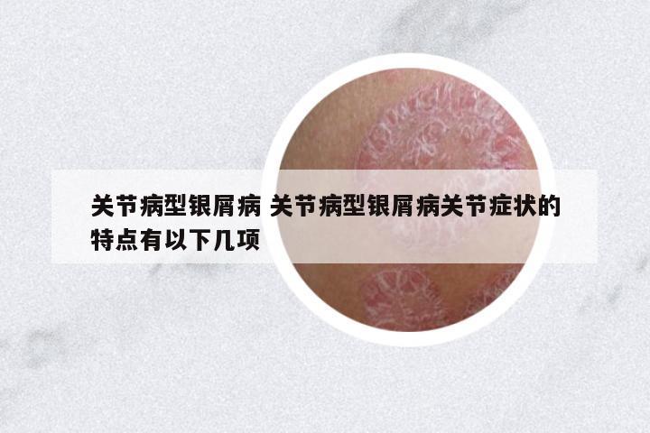 關節(jié)病型銀屑病 關節(jié)病型銀屑病關節(jié)癥狀的特點有以下幾項