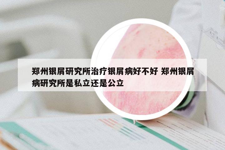 鄭州銀屑研究所治療銀屑病好不好 鄭州銀屑病研究所是私立還是公立