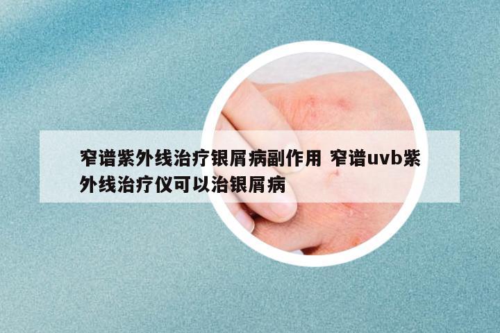 窄譜紫外線治療銀屑病副作用 窄譜uvb紫外線治療儀可以治銀屑病
