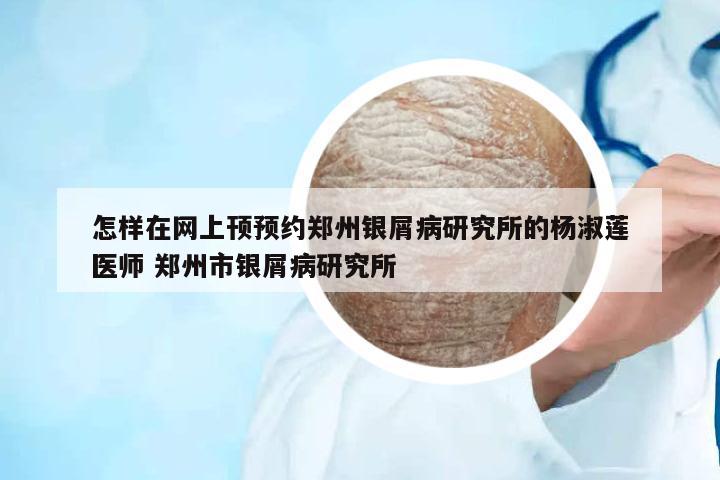 怎樣在網(wǎng)上頇預(yù)約鄭州銀屑病研究所的楊淑蓮醫(yī)師 鄭州市銀屑病研究所