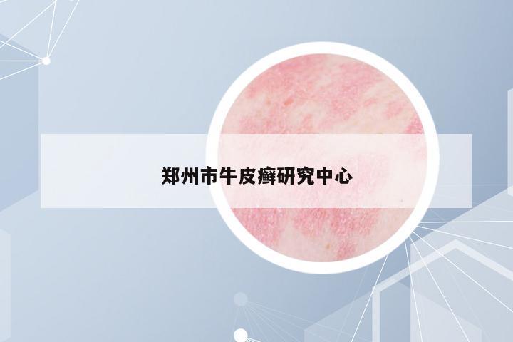鄭州市牛皮癬研究中心