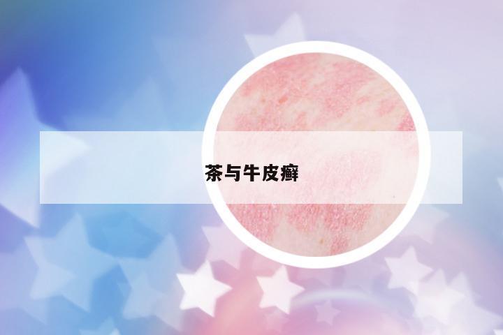 茶與牛皮癬