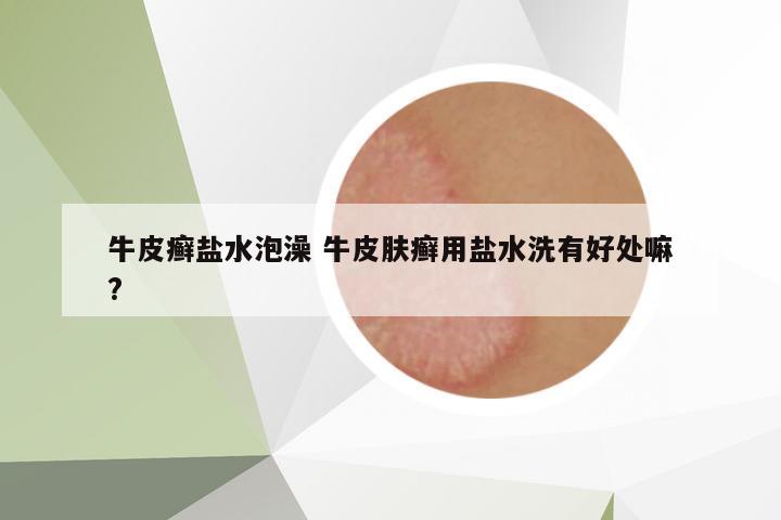 牛皮癬鹽水泡澡 牛皮膚癬用鹽水洗有好處嘛?