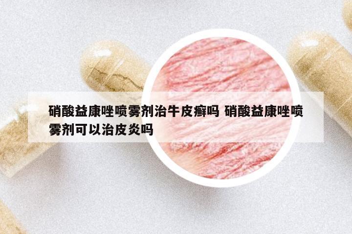 硝酸益康唑噴霧劑治牛皮癬嗎 硝酸益康唑噴霧劑可以治皮炎嗎
