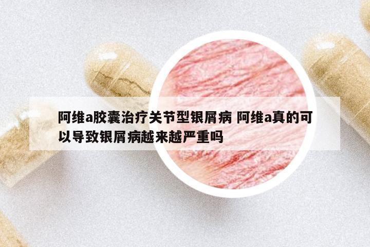 阿維a膠囊治療關節(jié)型銀屑病 阿維a真的可以導致銀屑病越來越嚴重嗎