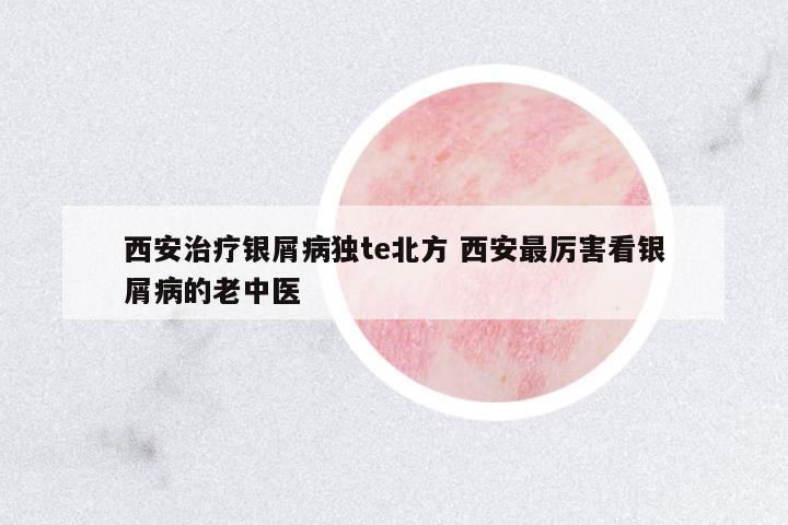 西安治療銀屑病獨(dú)te北方 西安最厲害看銀屑病的老中醫(yī)