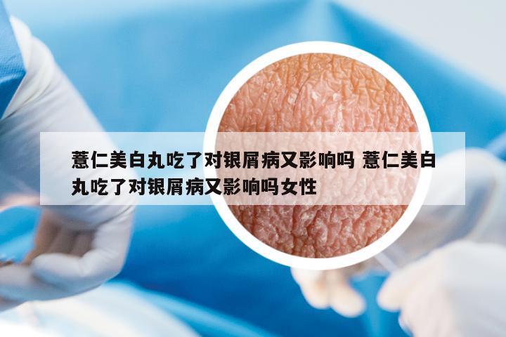 薏仁美白丸吃了對銀屑病又影響嗎 薏仁美白丸吃了對銀屑病又影響嗎女性
