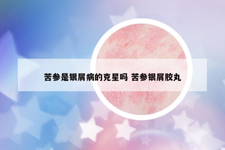 苦參是銀屑病的克星嗎 苦參銀屑膠丸